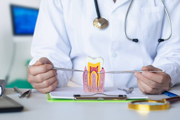 Best Knocked-Out Tooth (Avulsed Tooth) Treatment in Payson, IL