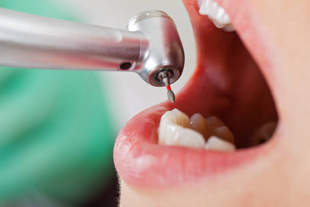 Best Walk-In Emergency Dental Services in Payson, IL